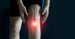 Although joint replacements generally tend to be successful, unfortunately, this isn’t always the case when joint replacements fail.