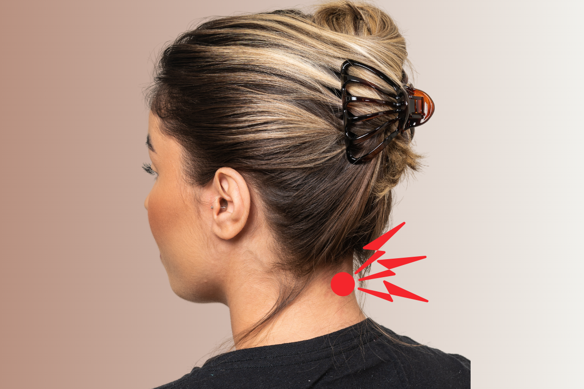 clips de cabello pueden causar lesiones serias