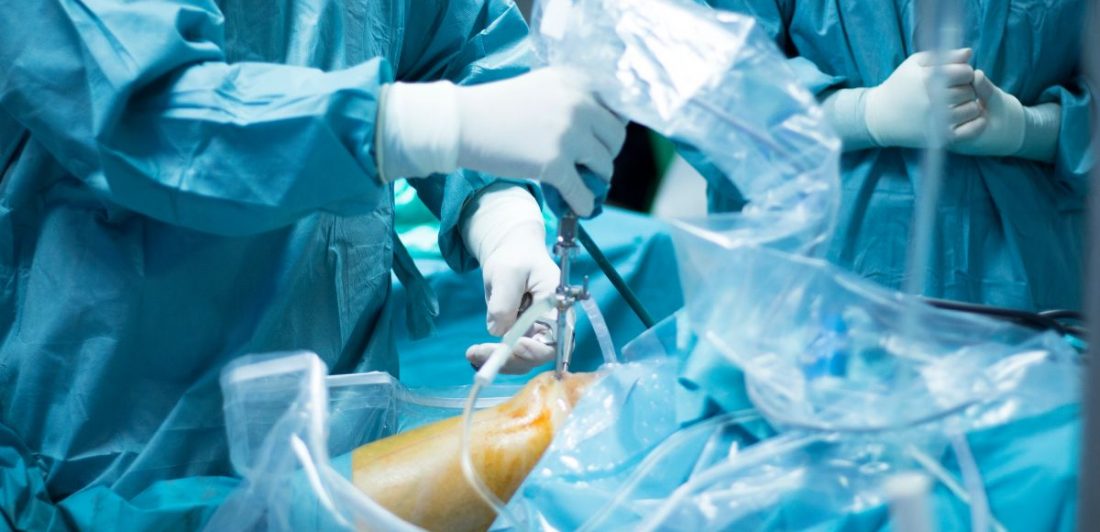 Ortho Joint Replacement