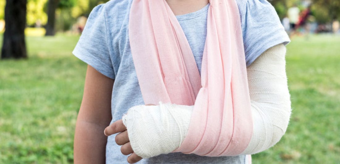 60132363 - little kid with broken hand and cast,selective focus