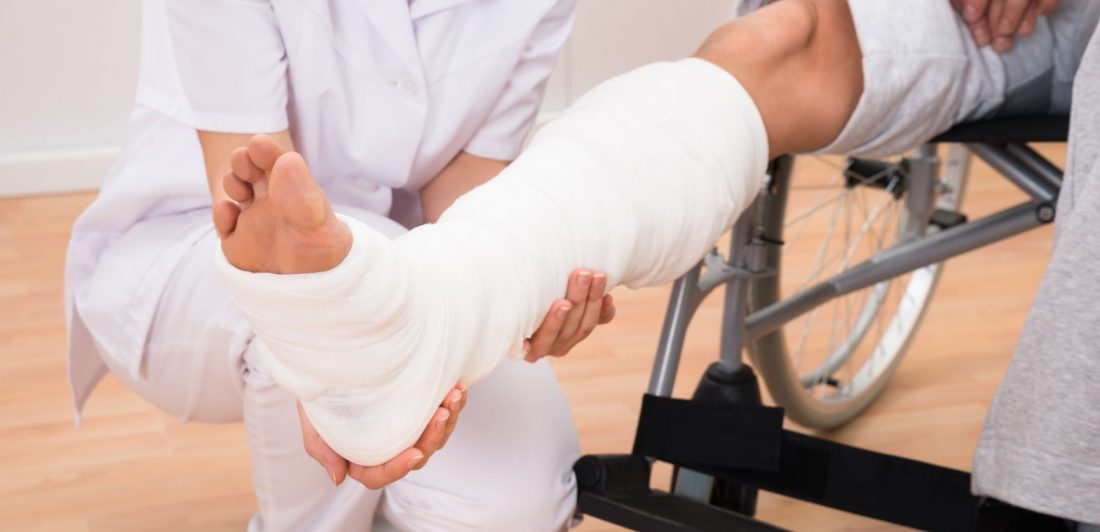 fracture photo fracturas por choque automovilístico