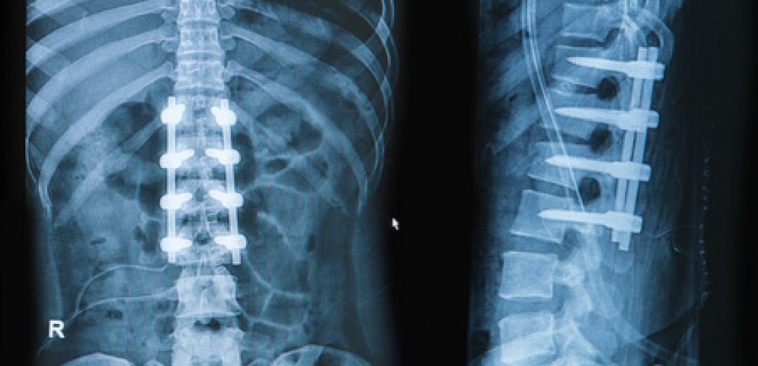 clasificaciones de dolor de espalda